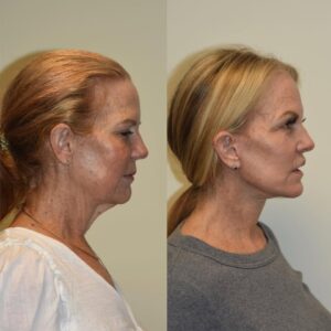 Hairstyles for Women Over 60